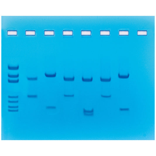 Ekperyment DNA Fingerprinting przy użyciu enzymów restrykcyjnych
